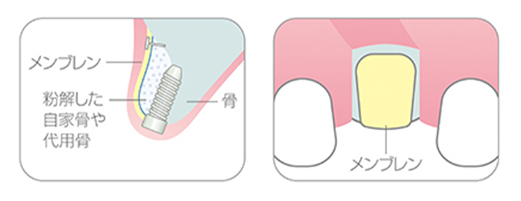 services_sec08_pic05